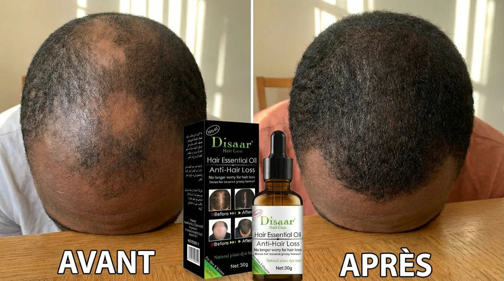 Huile Capillaire Disaar Anti-Chute – Active la Repousse &amp; Fortifie les Racines